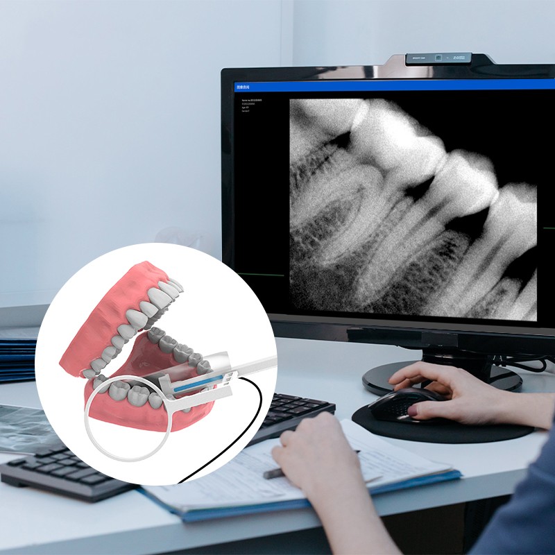Portable Dental Digital Sensor RVG Intraoral Digital System Sensor Radiovisiogra