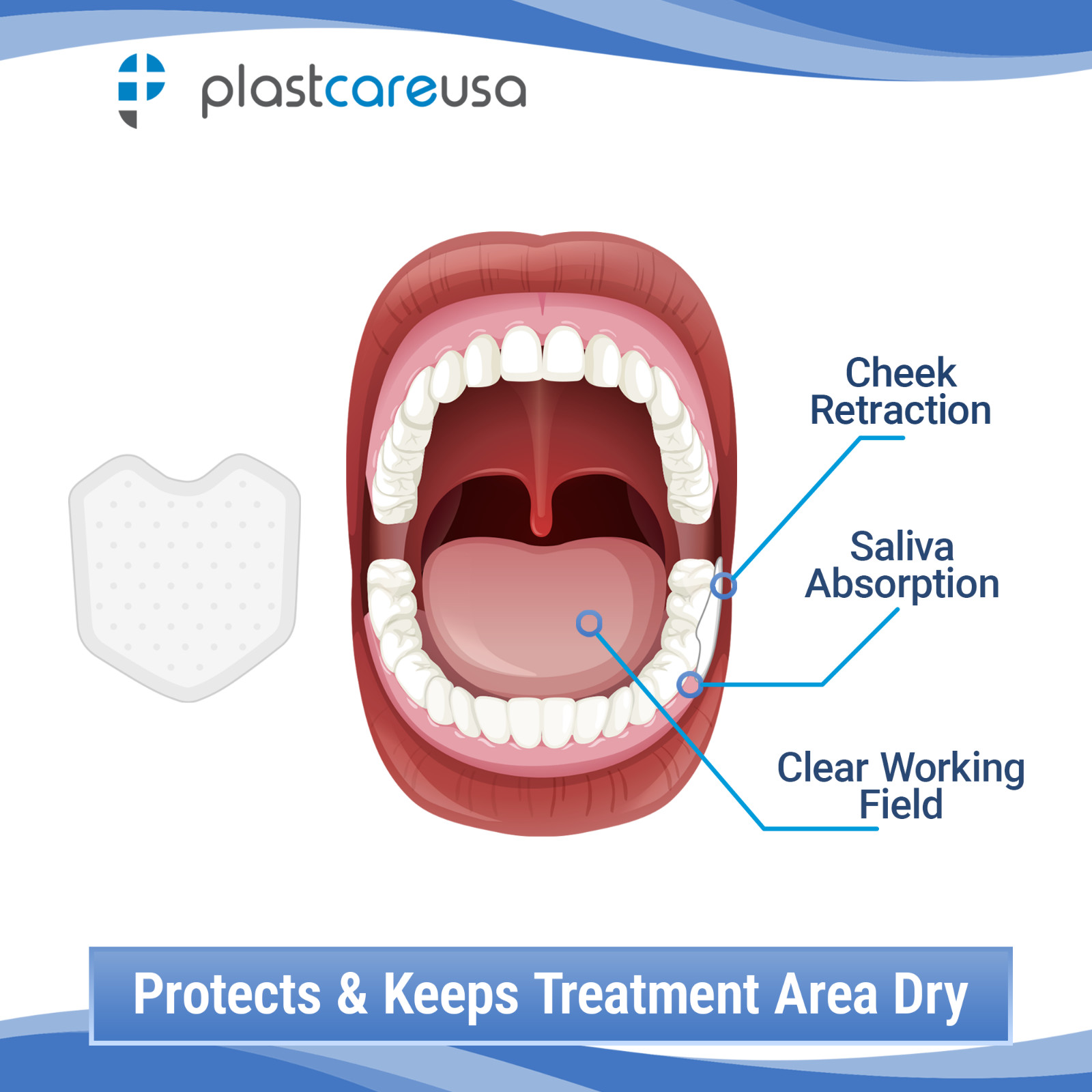 Dental Dry Angles Saliva Absorbent Pads – Parotid Shield Moisture Control (S/L)