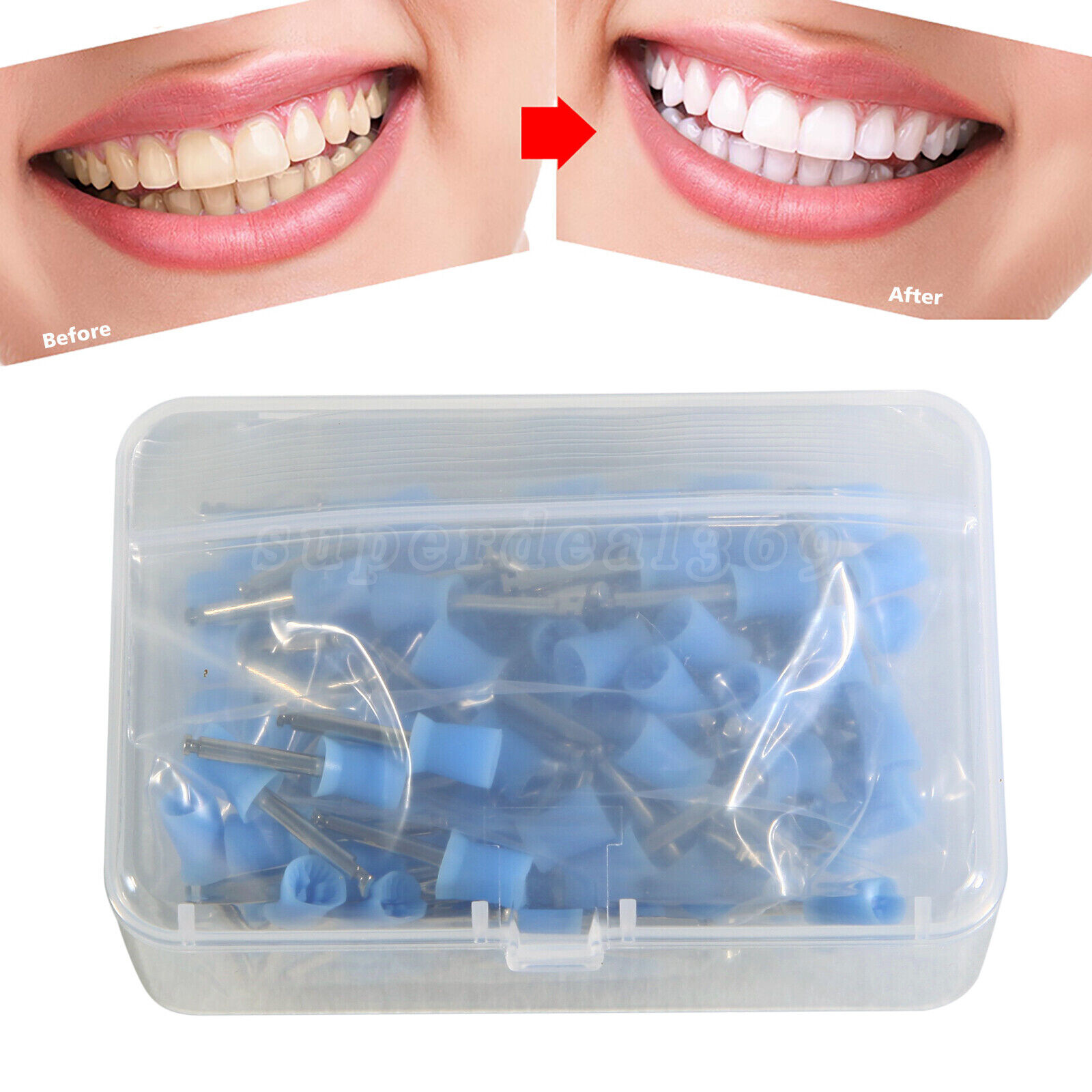 100-1000pc Dental Tooth Prophy Polishing Cups Polish brushes Blue/White/Green cx