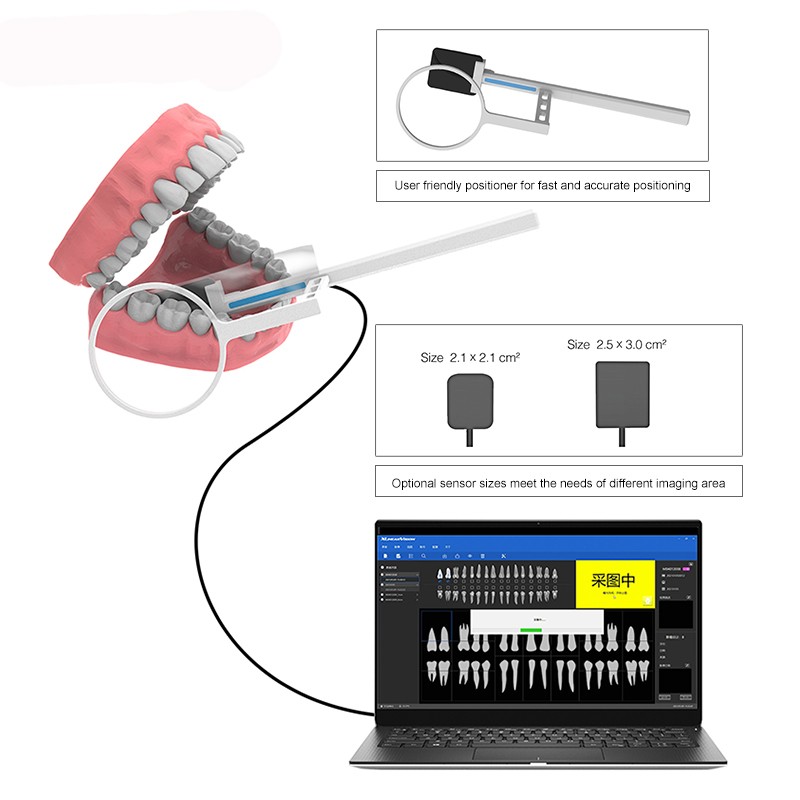 Portable Dental Digital Sensor RVG Intraoral Digital System Sensor Radiovisiogra