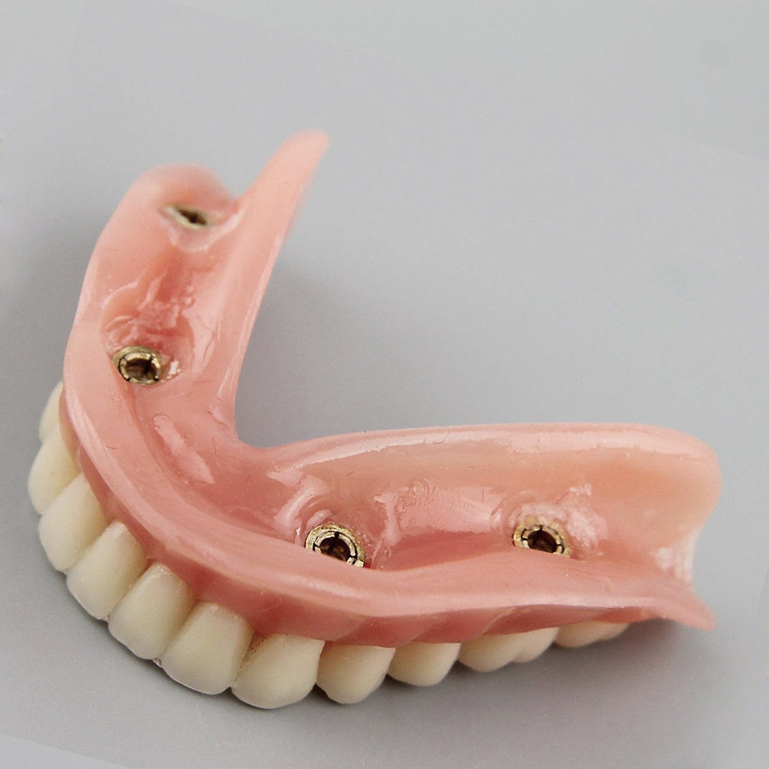 Dental Model Overdenture Inferior 4 Implants Demo for Teaching and Studying