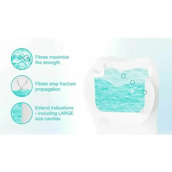 GC Everx Posterior Composite Resin Reinforced with Fibre for Dental Restorations