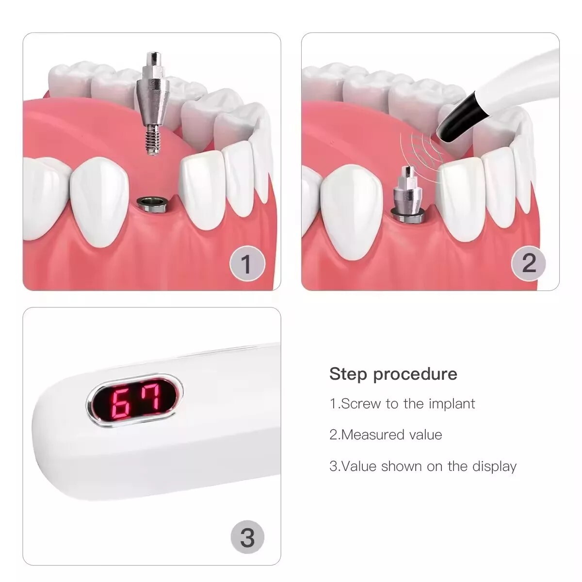 DENTAL NEW OSSEOINTEGRATION IMPLANT STABILITY METER FAST SHIPPING