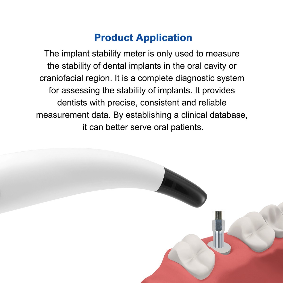 Dental Osstell Beacon ISQ Implant Stability Meter Osseointegration Monitor WJ