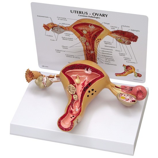 Uterus Ovary GPI Anatomy Model with Key LFA #3480. Make Us an Offer! SEE VIDEO