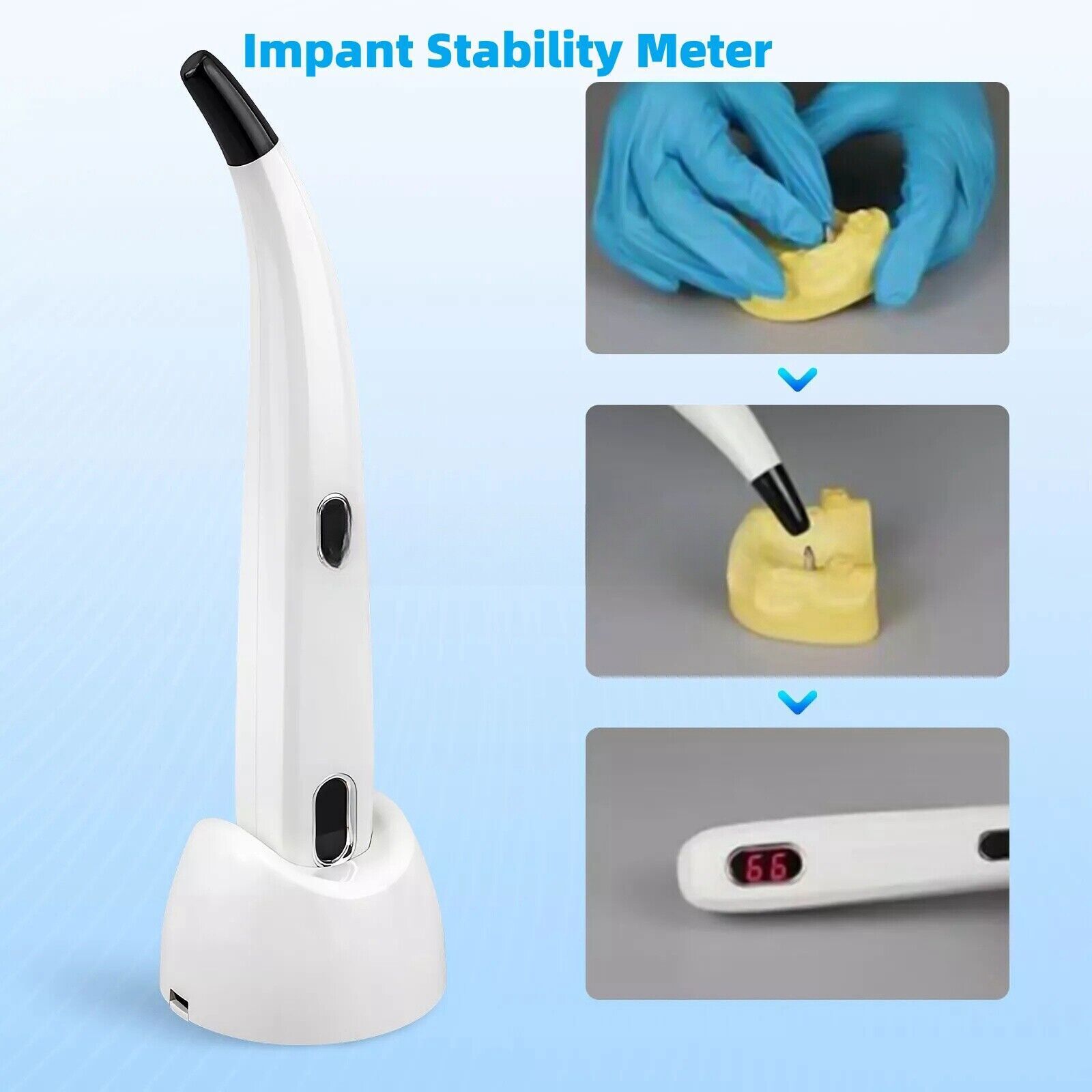 Dental Implant Stability Meter Implant Abutment Stability Measurement Tester