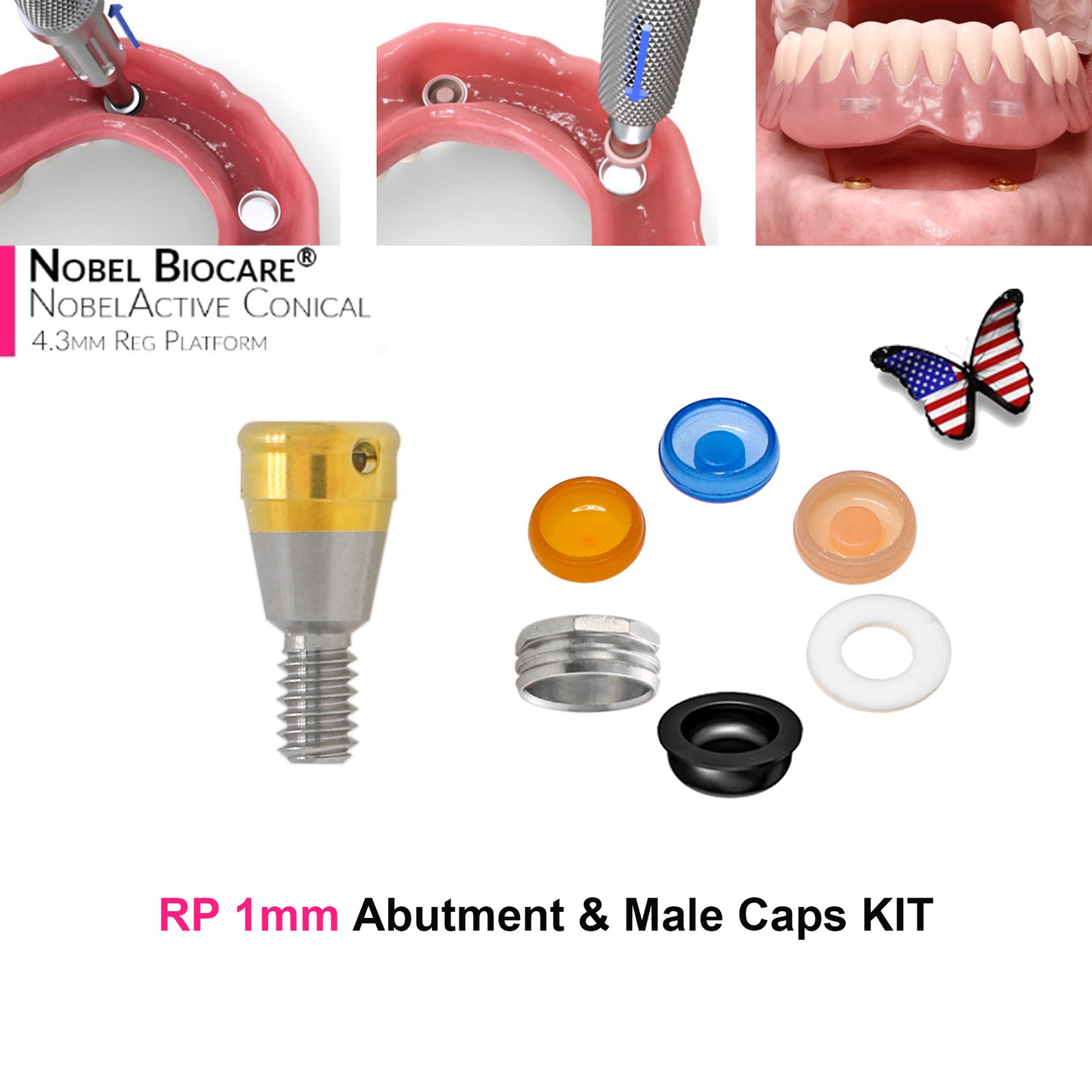 US Dental Titanium ZEST Classic Locator Overdenture Abutment Fit Nobel Biocare