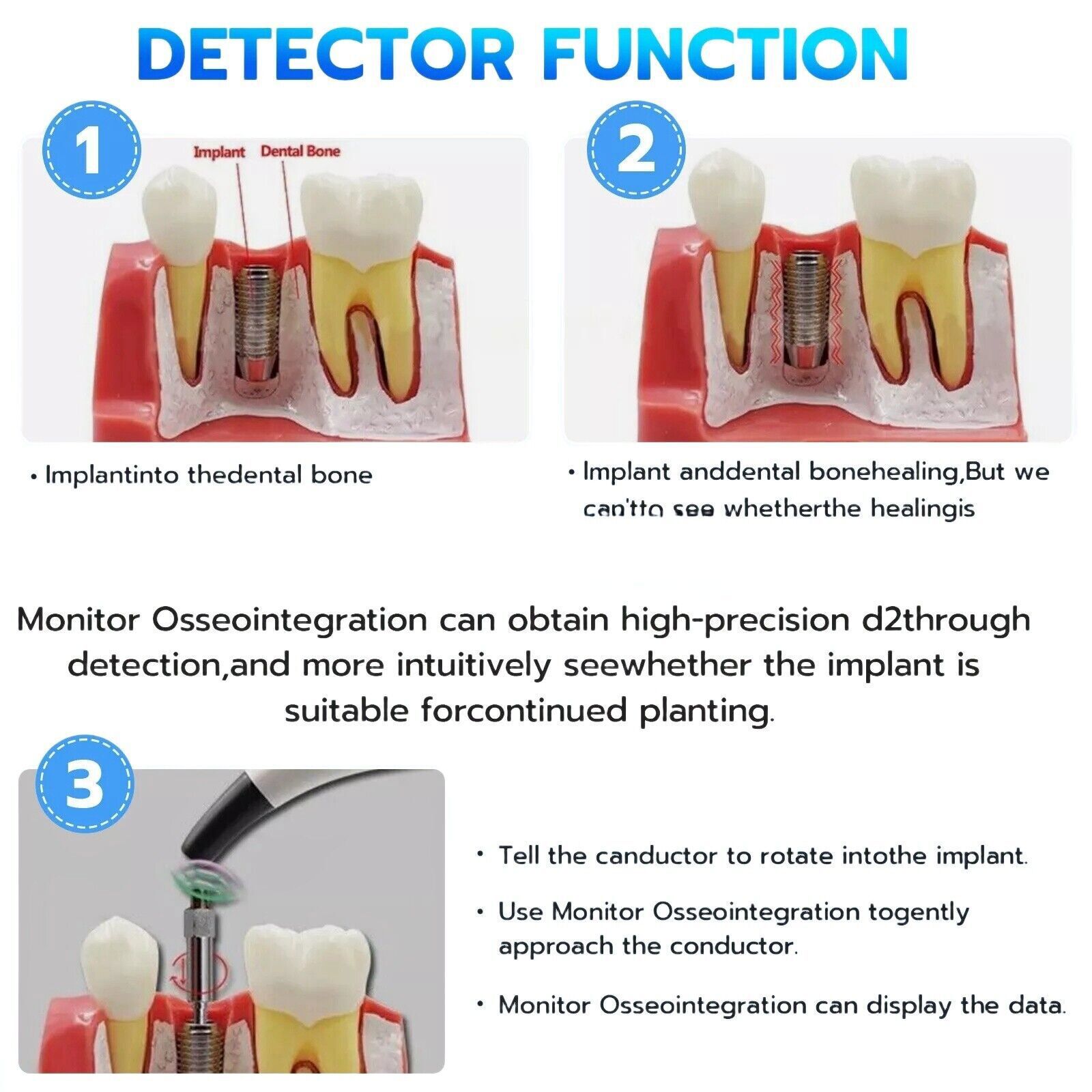 Dental Implant Stability Meter Implant Abutment Stability Measurement Tester