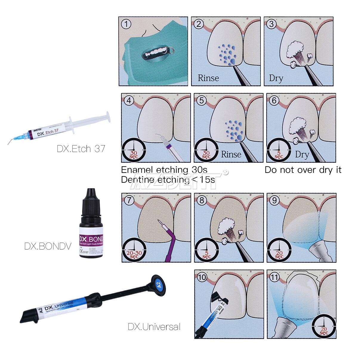Resina compuesta curado por luz Universal Dental A2/Gel grabado/adhesivo unión