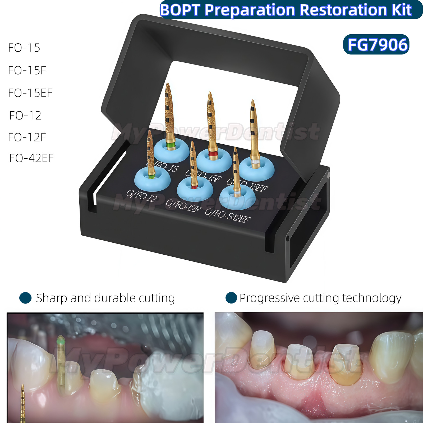 Dental Preparation Bur BOPT Kit Vertical Restoration Crown Restoration FG7906