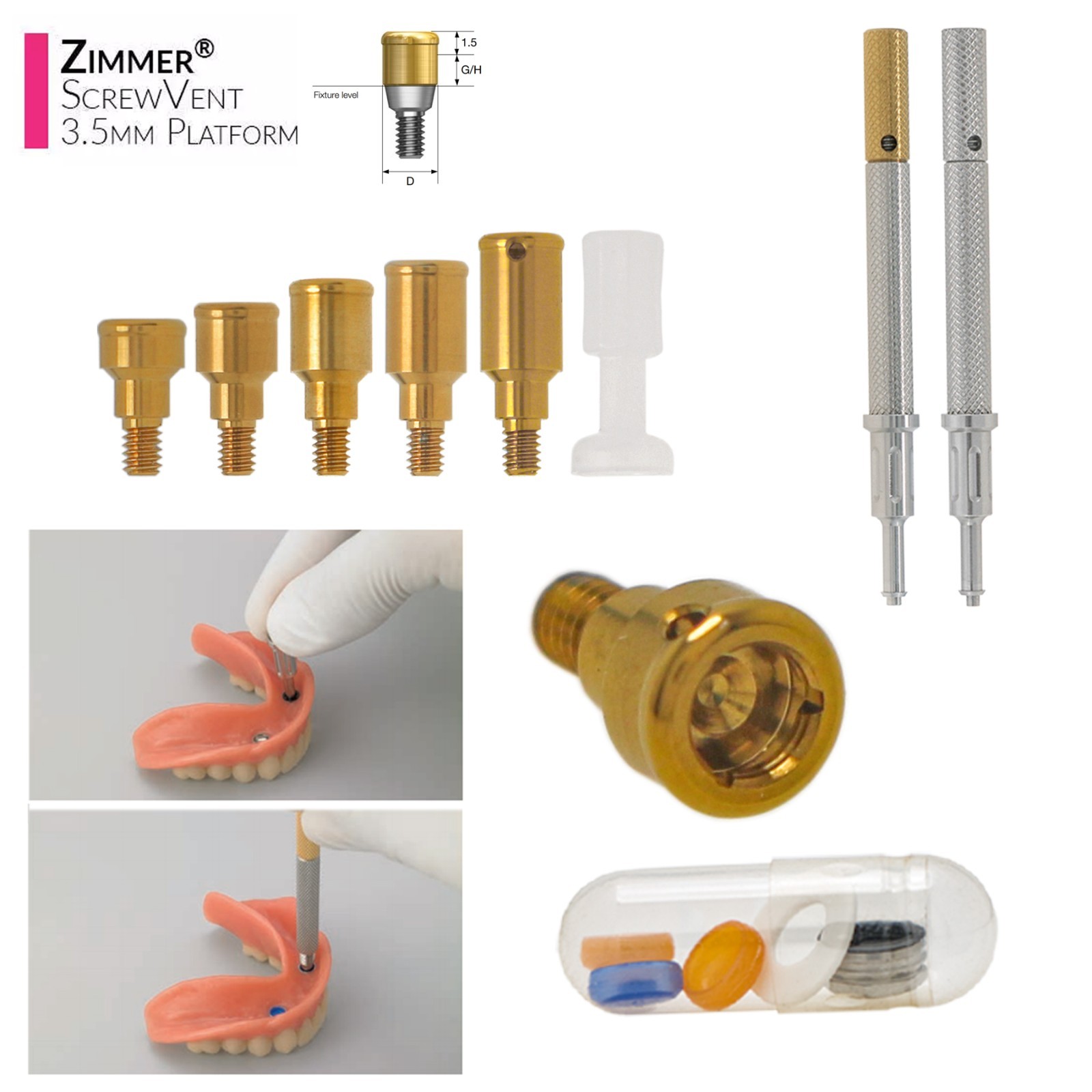 Overdenture Attachment Kit Locator abutment for BioHorizons Implant Accessories