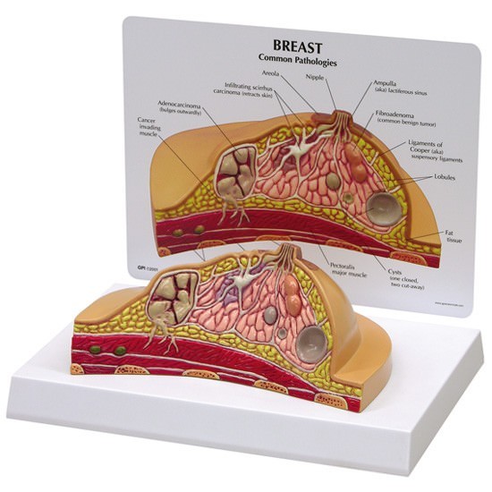 Breast CrossSection GPI Anatomy Model wKey LFA #3450 Make Us an Offer SEE VIDEO