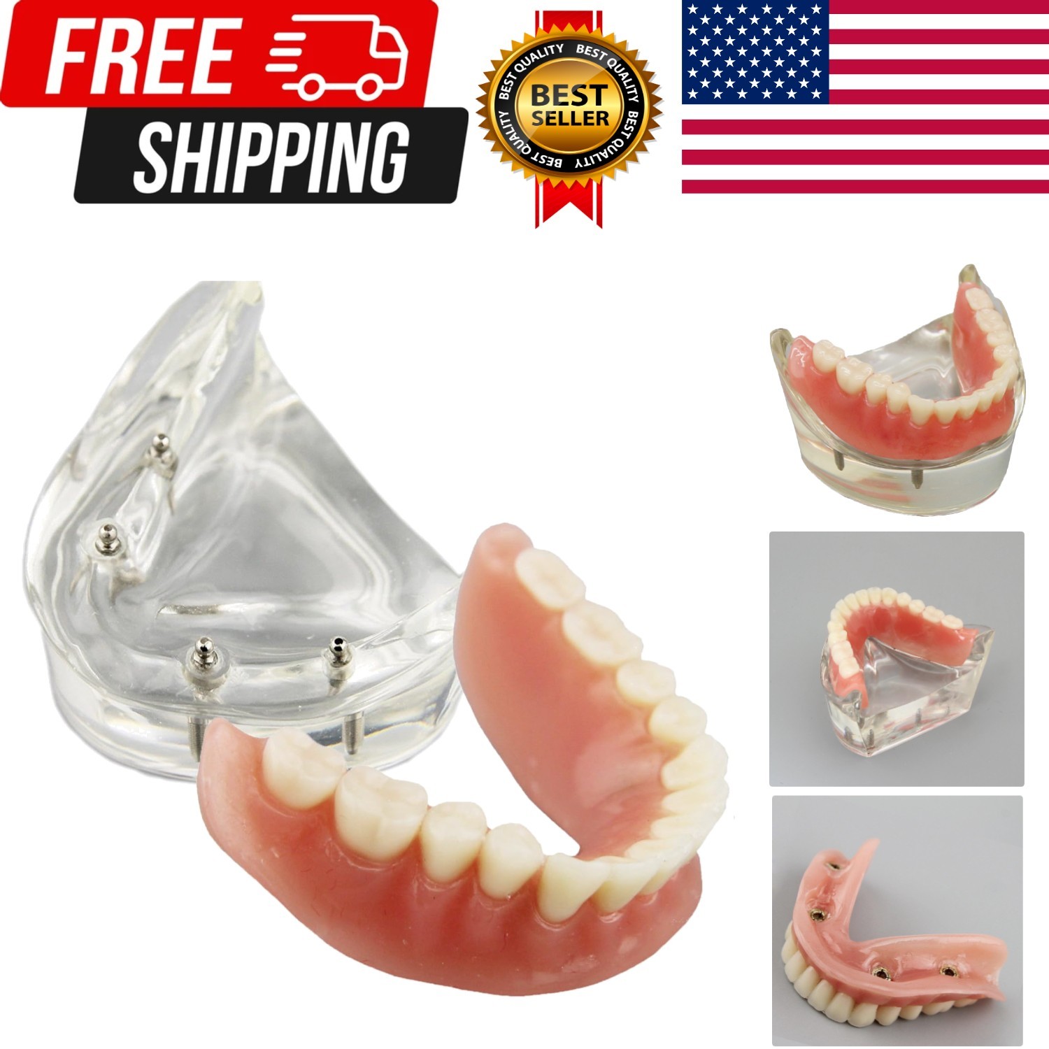 Dental Model Overdenture Inferior 4 Implants Demo for Teaching and Studying