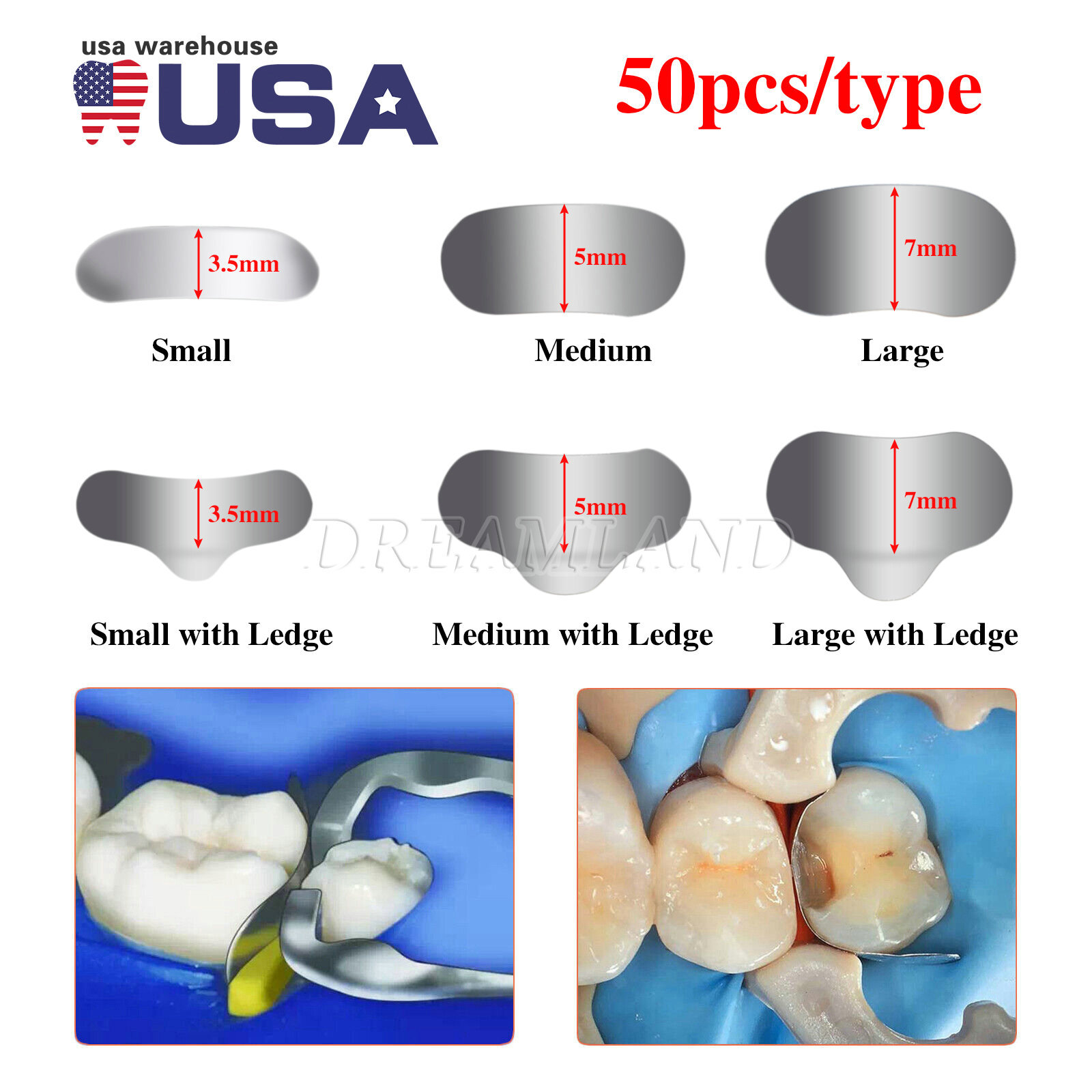50Pcs Dental Metal Matrices Matrix Band Sectional Contoured Refill S/M/L 35μm DK