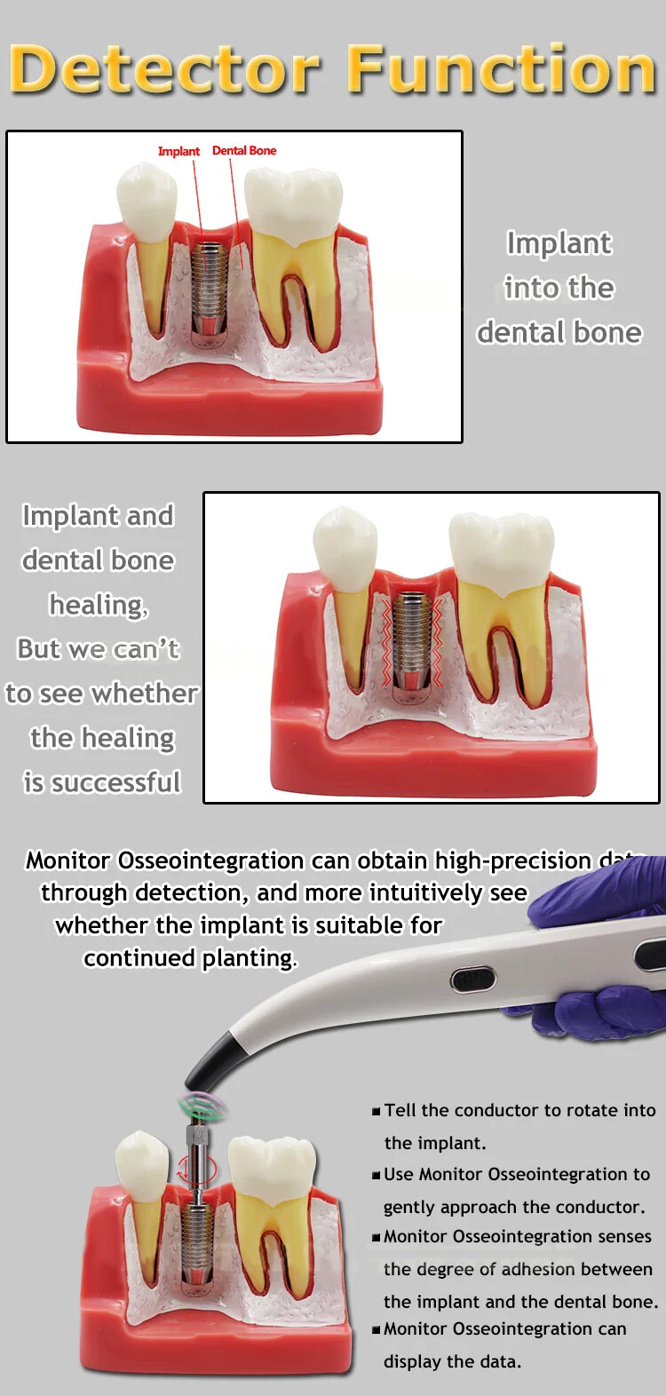 DENTAL NEW OSSEOINTEGRATION IMPLANT STABILITY METER FAST SHIPPING