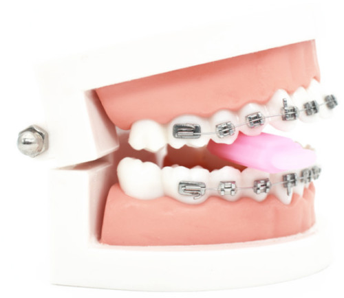 Aligner Chewies Mouth Tray Seaters Pink Juicy Peach Brace