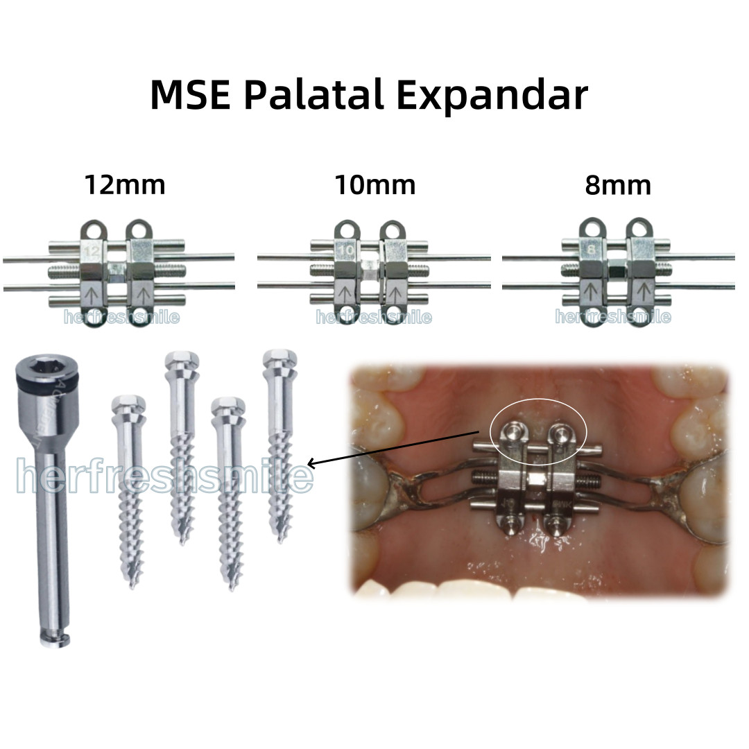 MSE Dental Expansion Screw Facial Rapid Split Hyrax Maxillary Skeletal Expander
