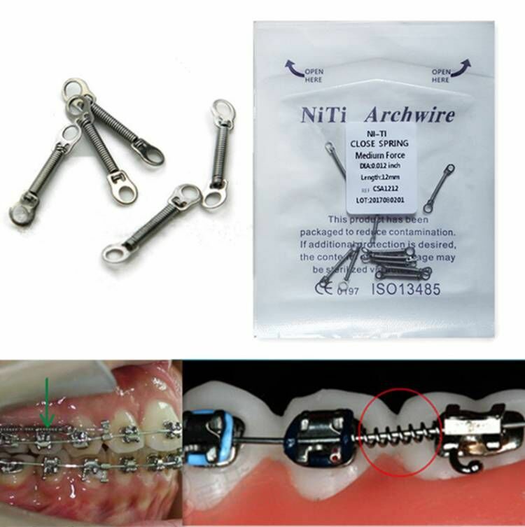 100 Pcs Dental Orthodontic Niti Alloy Closed Coil Spring 010/012 6/9/12mm
