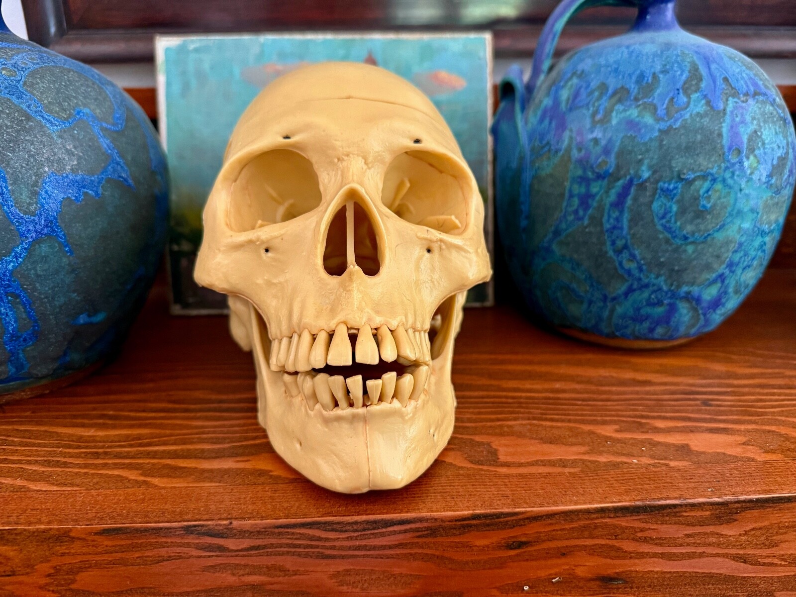 Amazing Vintage Medical Model Skull With 76 On One Tooth Articulating Jaw 7 1/2″