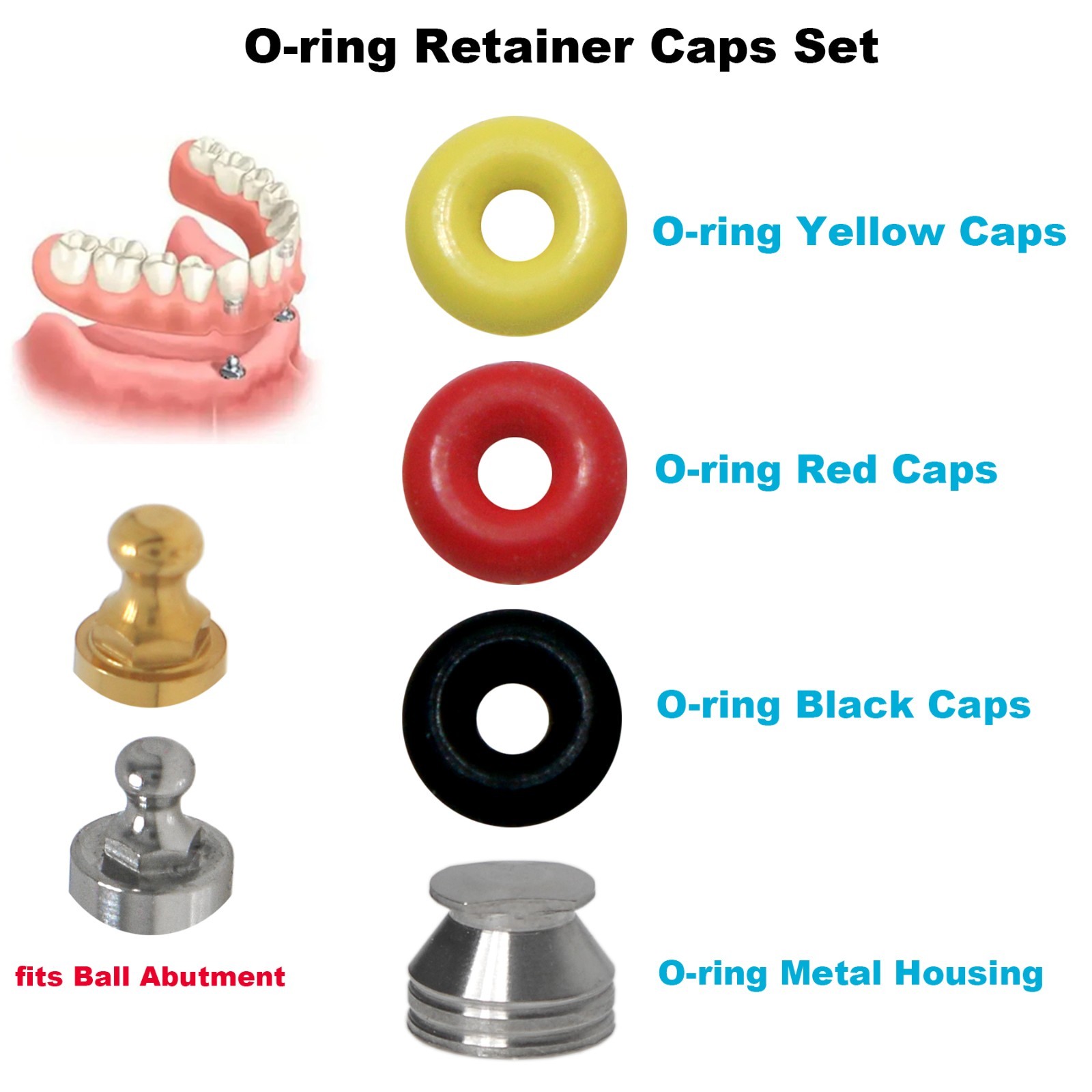 Dental O-ring Retention Caps Implant Kit Fits Ball Abutment For Hiossen Osstem