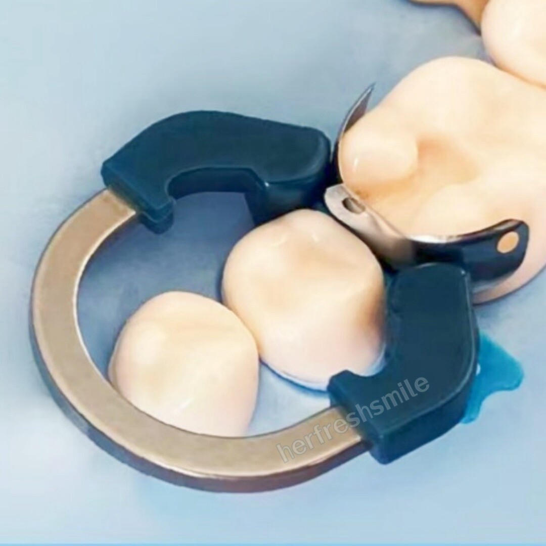 Dental Titanium Ring Matrix System Clamp Use Million Times Composite Restore