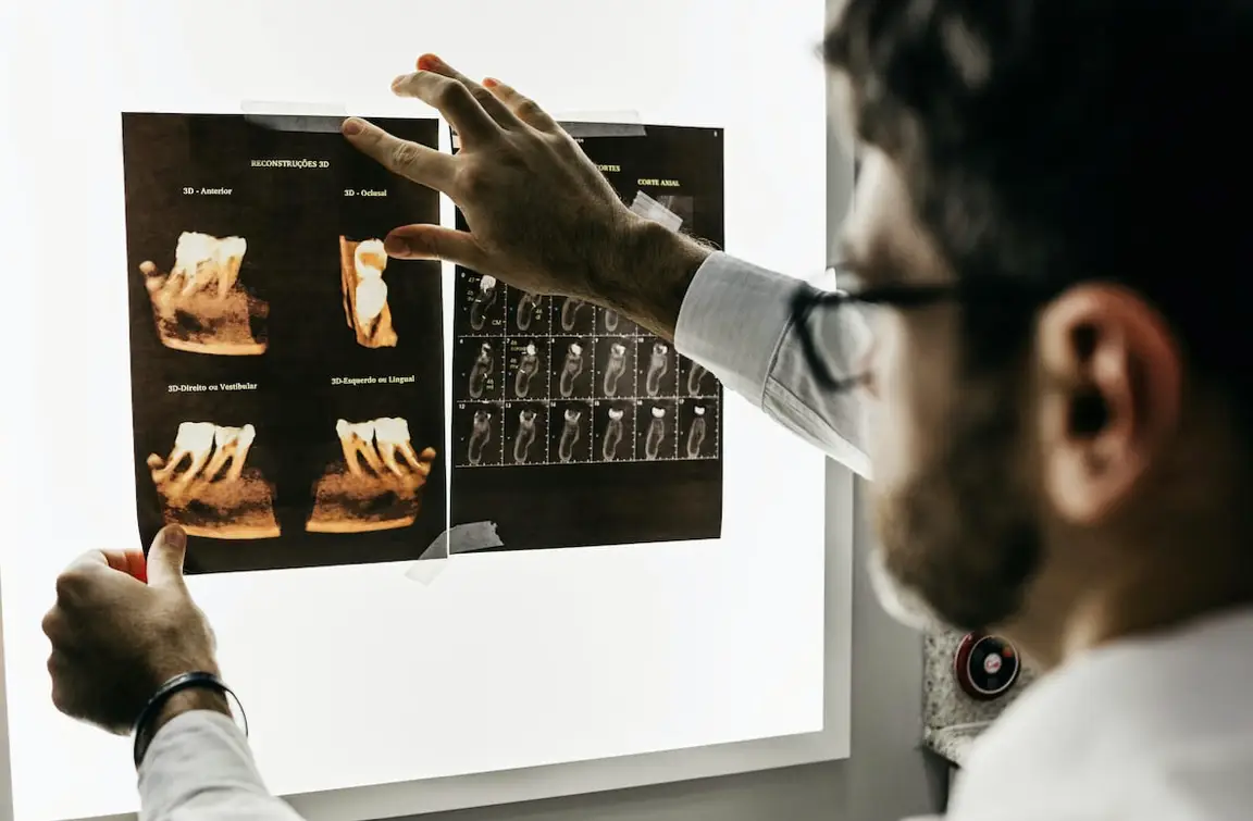 RADIOGRAFÍAS DENTALES